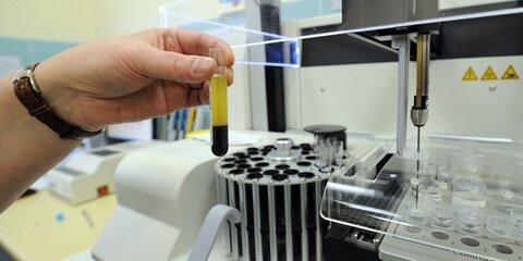 В ГКБ №67 заработала автоматизированная лаборатория микробиологии