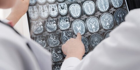 Ученые выяснили, как легко улучшить работу мозга