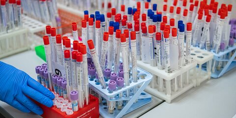 Свыше 3,7 млн тестов на коронавирус проведено в России