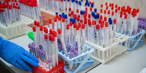 В Москве провели миллион тестов на коронавирус