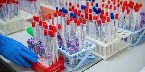 Свыше 8 млн тестов на коронавирус провели в России